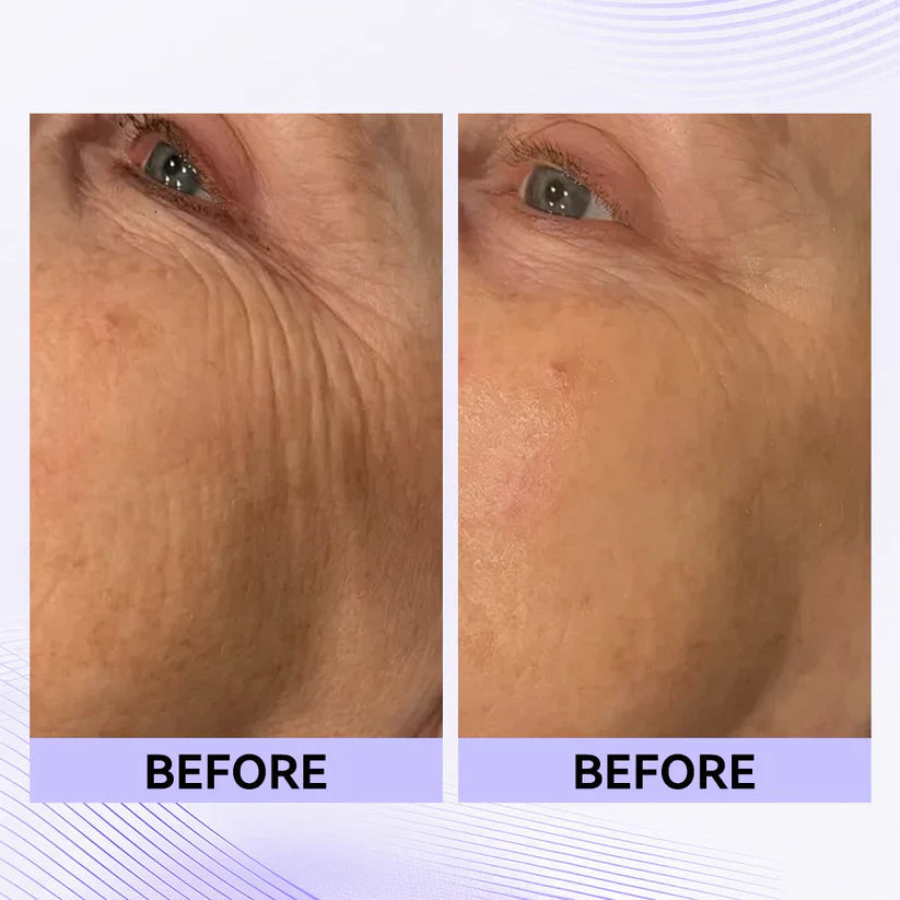 Instant face Tightener